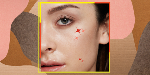 How To Treat Popped And Unpopped Pimples How To Get Rid Of Acne How To Treat Popped And Unpopped Pimples How To Get Rid Of Acne