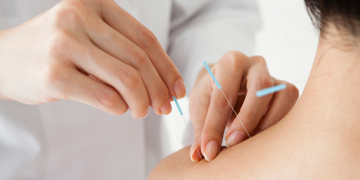 Acupuncture for Joint Pain: Does It Actually Work?