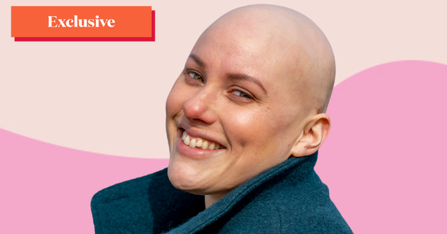 laura mathias writes about living with alopecia for women's health