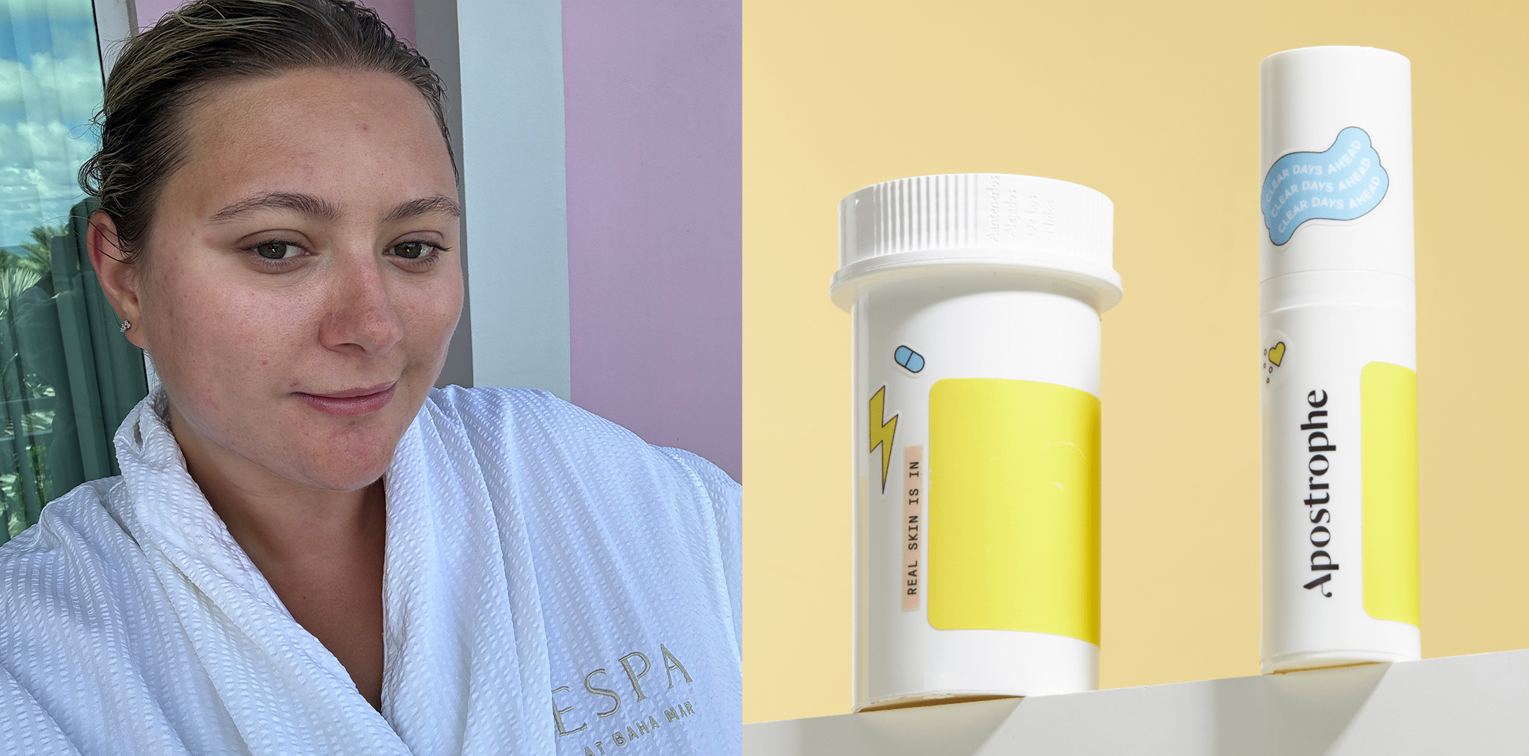 Skip the Expensive Dermatologist Visits with These Online Acne Prescriptions