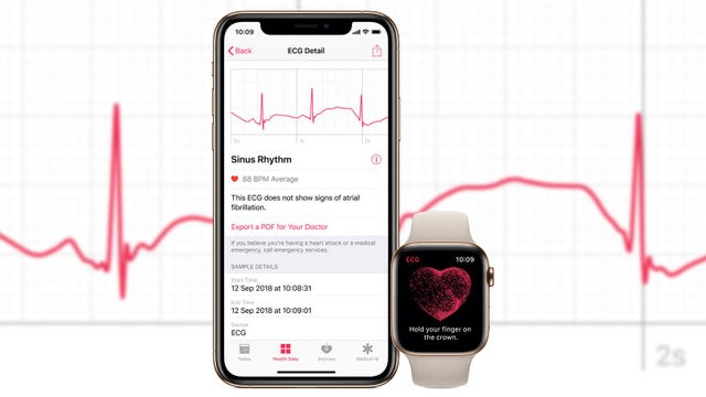 ecg update apple watch
