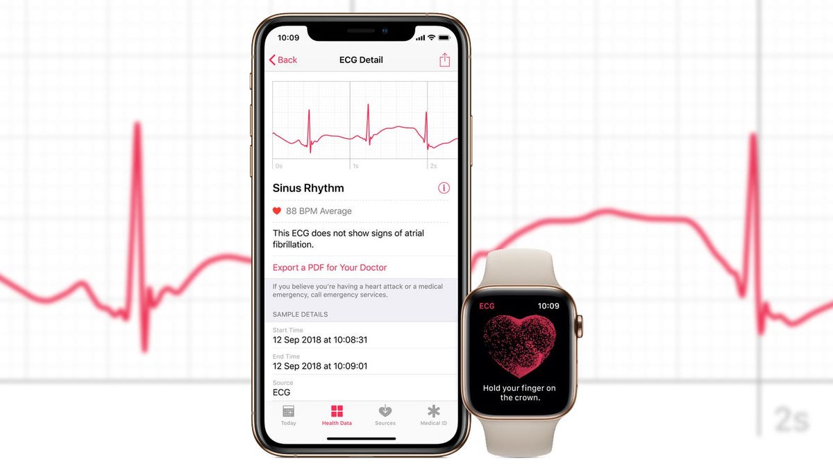 apple watch 4 ecg update