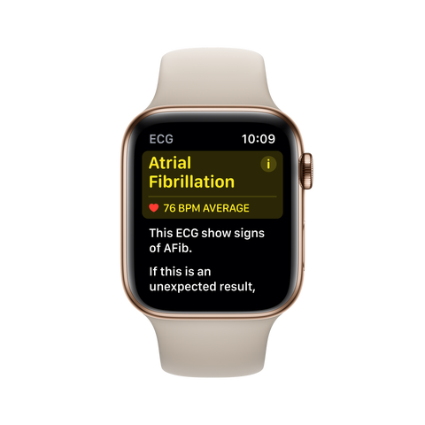 age test heart my The Here Update ECG Watch's Is EKG Apple Review Watch Apple age test heart my The Here Update ECG Watch's Is EKG Apple Review Watch Apple