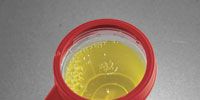 Product, Yellow, Circle, Laboratory equipment, Plastic, Transparent material, Petri dish, Cylinder, 