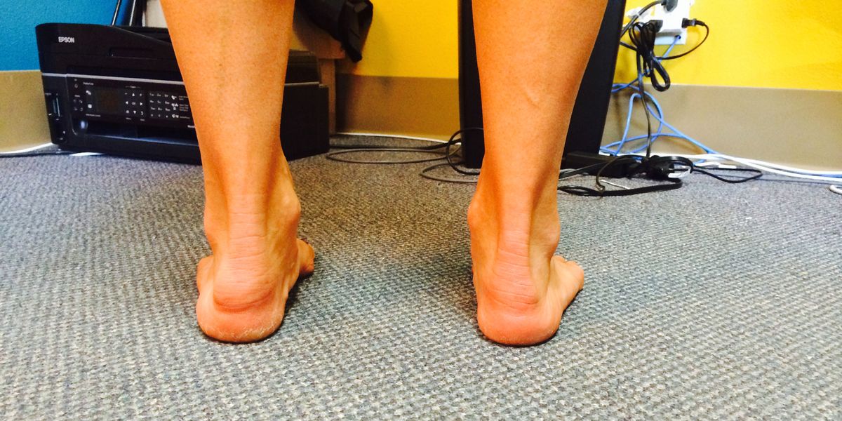The Aging Athlete: Why Does My Heel Look Like A Swollen Butt Cheek ...