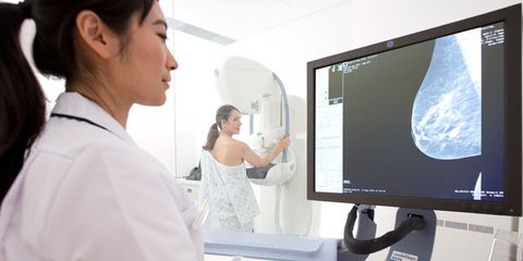 Why getting a mammogram at 40 might not be worth it