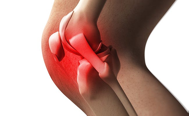 foods-that-cause-joint-pain-prevention