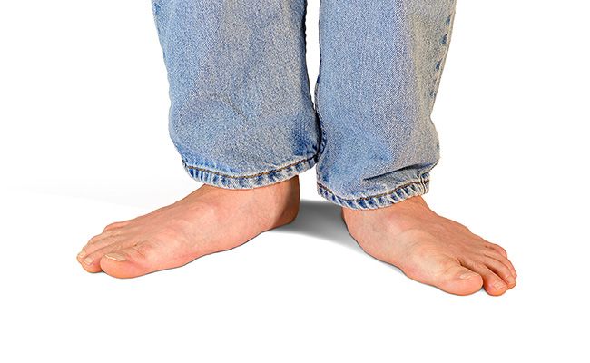 flat feet pain treatment