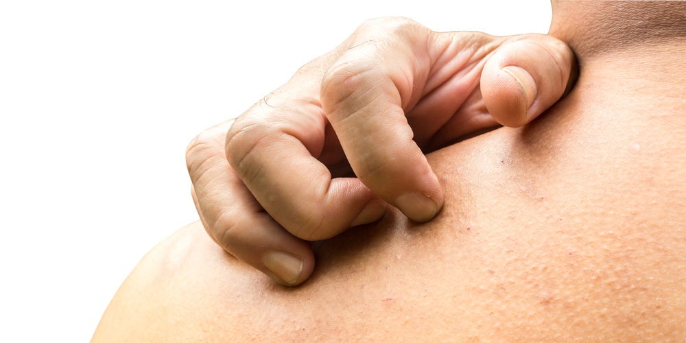 Why Your Skin Itches When You Run | Men's Health Why Your Skin Itches When You Run | Men's Health