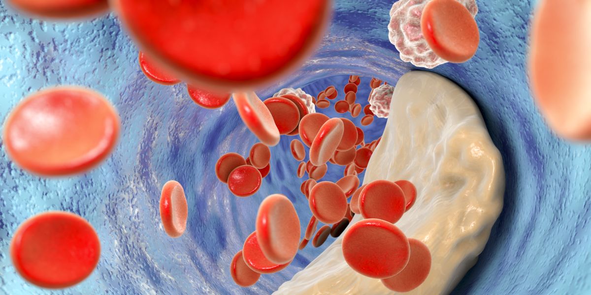 4 vital things that doctors say everyone should know about cholesterol