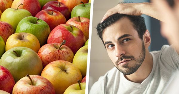 Eating More of These 5 Fruits Could Slow Down Baldness