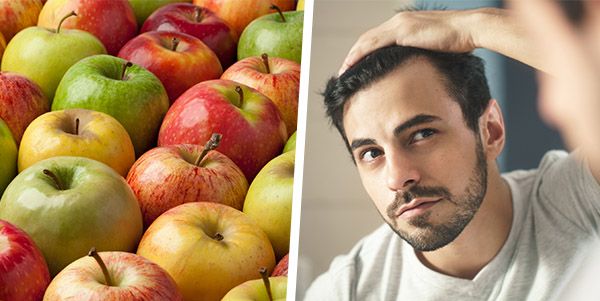 Eating More of These 5 Fruits Could Slow Down Baldness