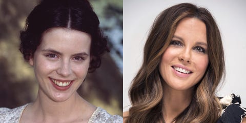 Celebrity Smiles Before and Afters - Celebrity Dental Work
