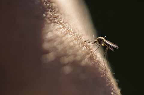 Picadura de mosquito
