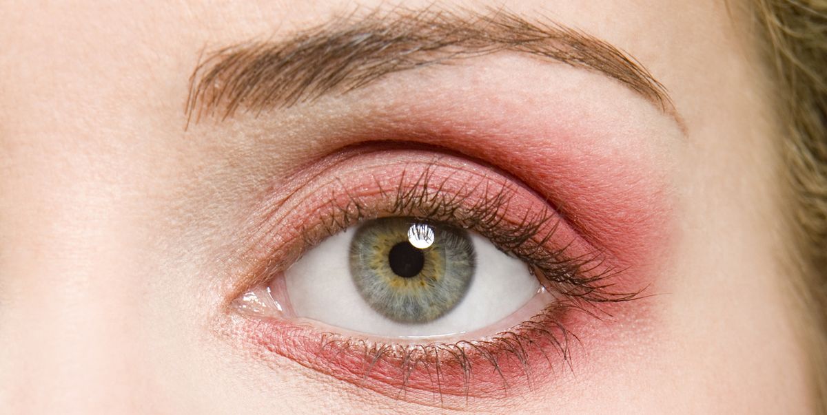 Blepharitis Sore, Itchy, Red Eye Causes And Symptoms-6804