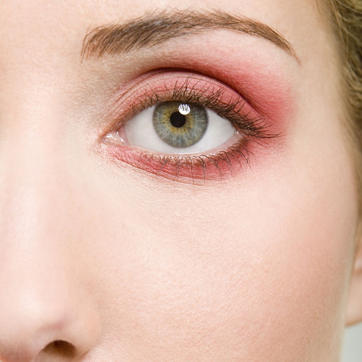 Blepharitis: sore, itchy, red and