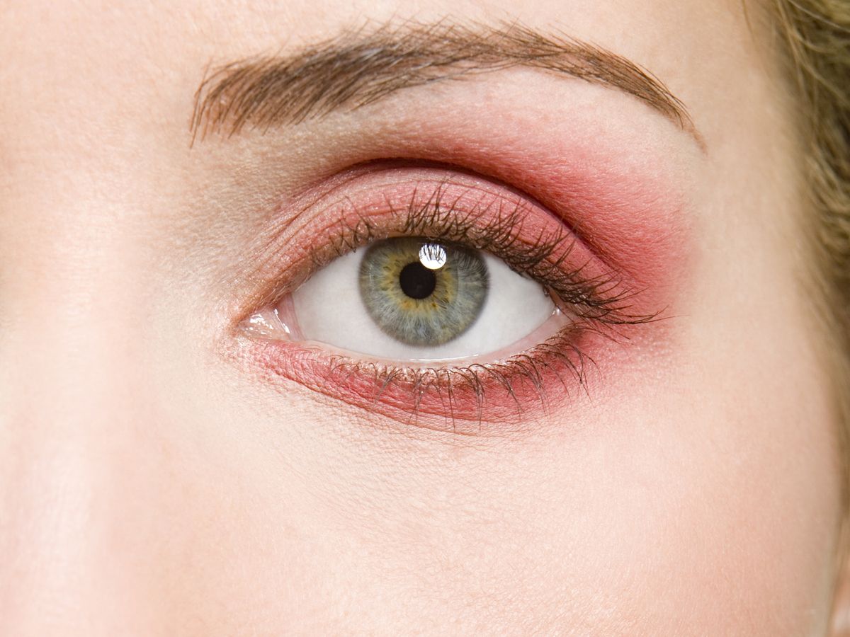 inden for Ruin Specialist Blepharitis: sore, itchy, red eye causes and symptoms