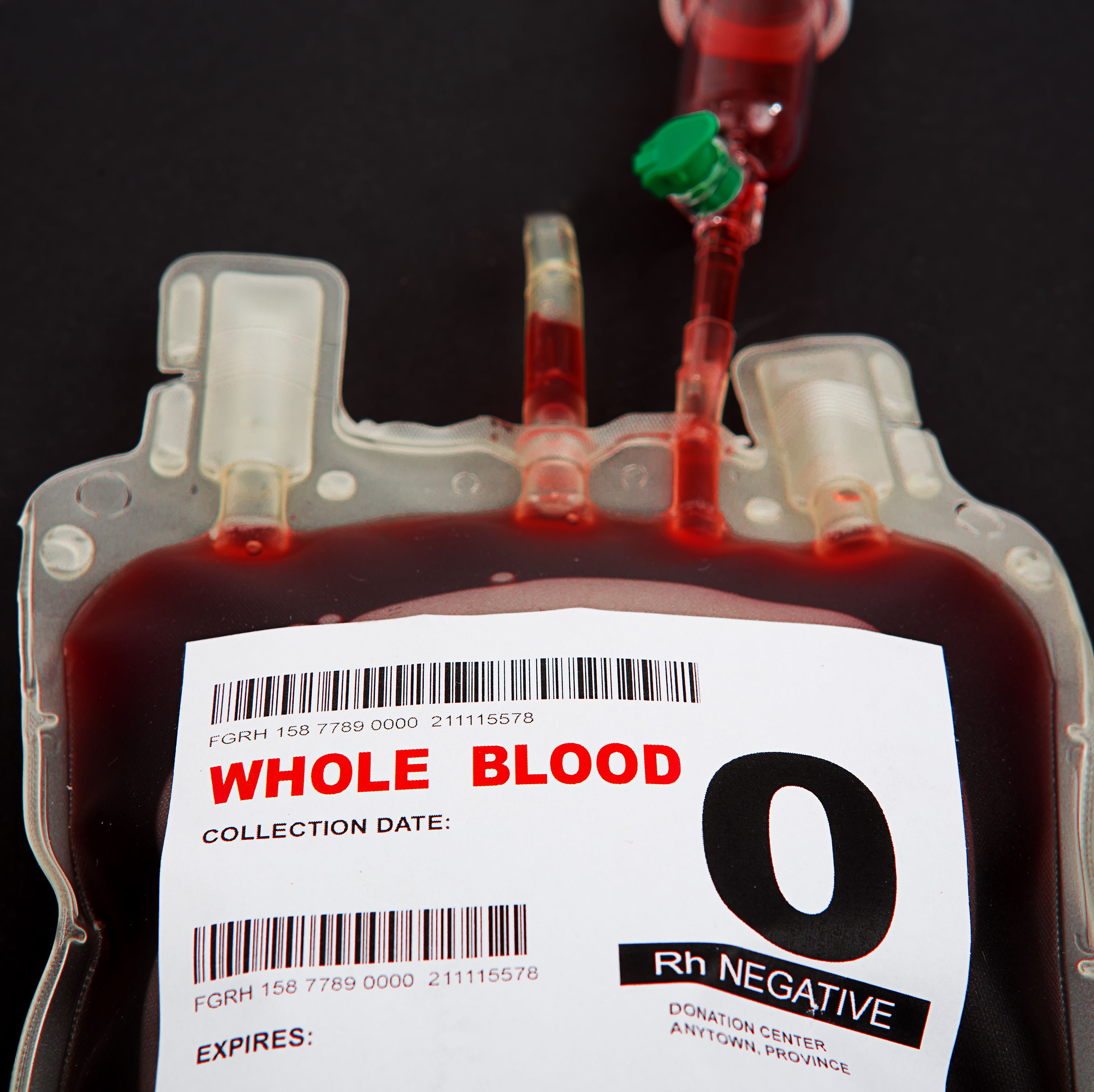 This Startup Claimed Its Blood Transfusions Could Reverse Aging. Then, the FDA Stepped In