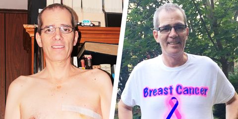 male breast cancer