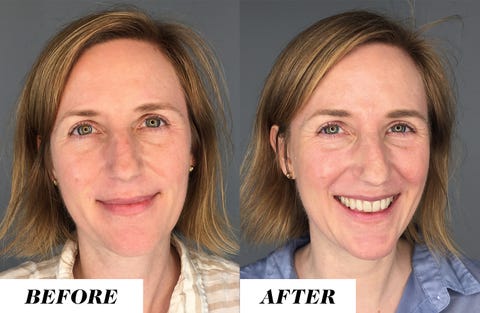 Does Drinking Water Help Your Skin - Facts on Drinking Water for Acne, Wrinkles, and Skin Problems Does Drinking Water Help Your Skin - Facts on Drinking Water for Acne, Wrinkles, and Skin Problems