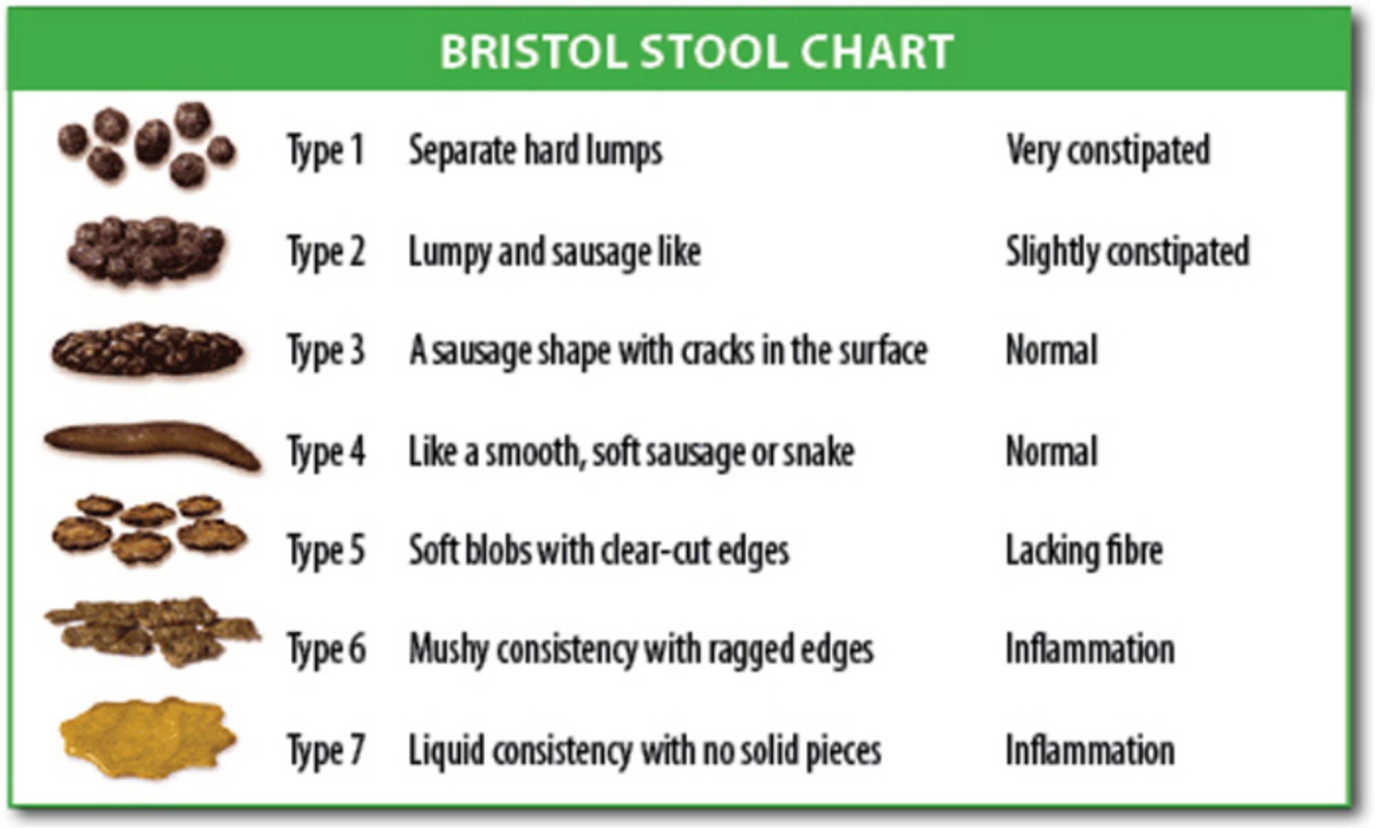 7 Textures Of Poop And What They Mean - Bristol Stool Chart