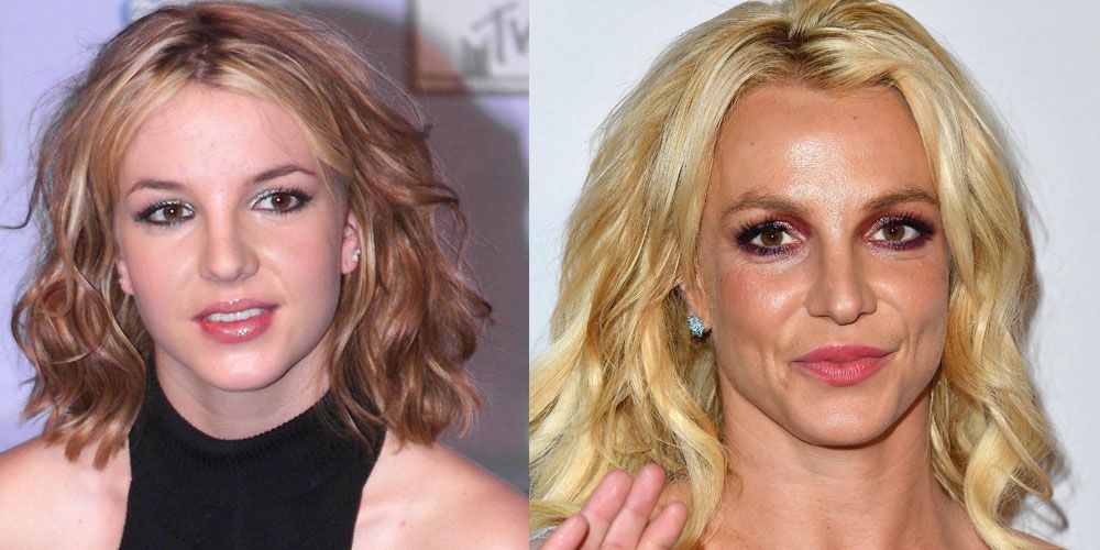 free celebrity before and after plastic surgery