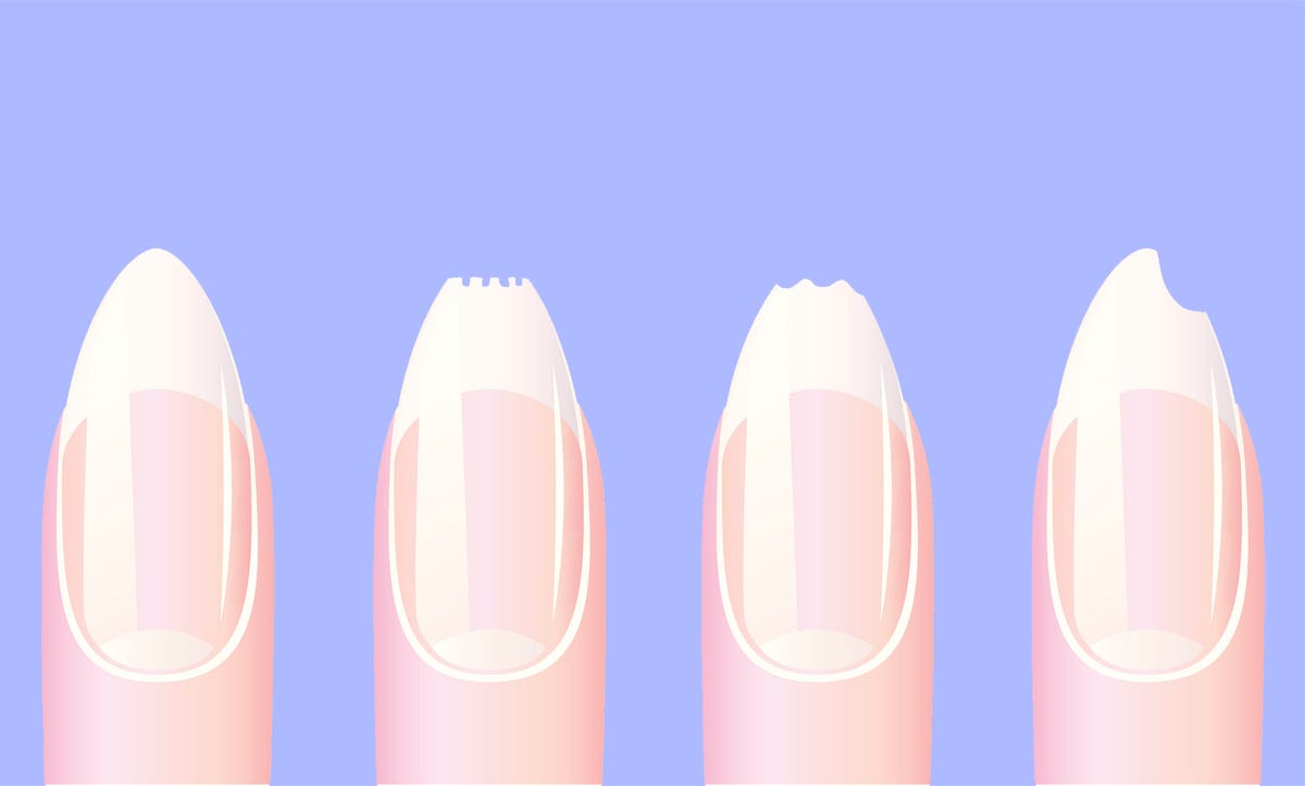 8 Reasons For Brittle Nails Causes and Treatments for Weak Nails