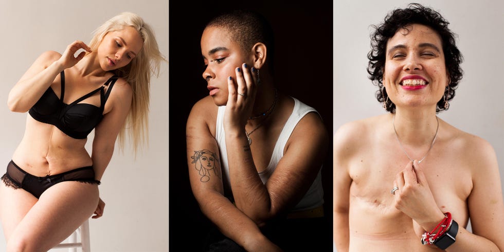 Photo Series Celebrates the Beauty and the Story Behind the Scars