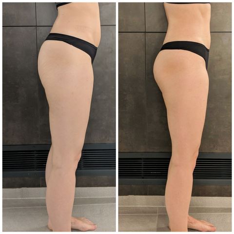 Before and after butt workouts