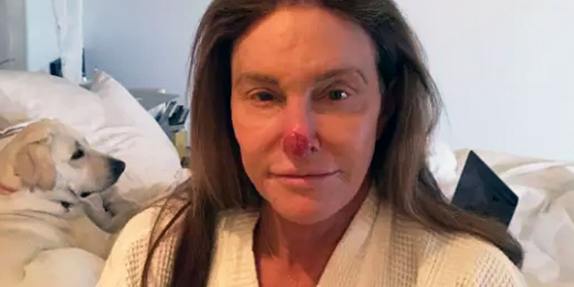 Bruce Jenner Sex Porn - Caitlyn Jenner Posts a Pic of Her Skin Cancer to Instagram ...