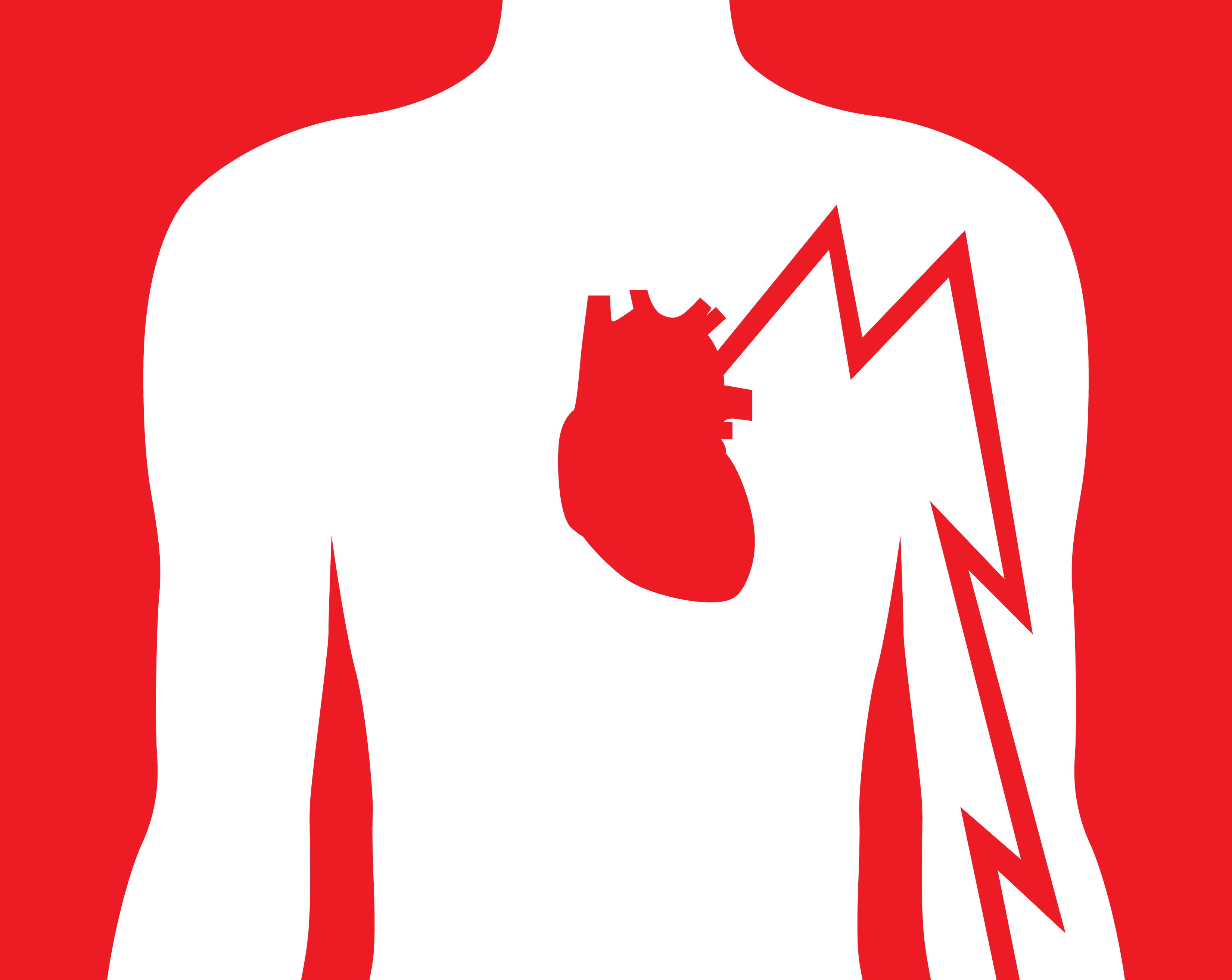 Cardiac Arrest: Symptoms, Causes & Treatment