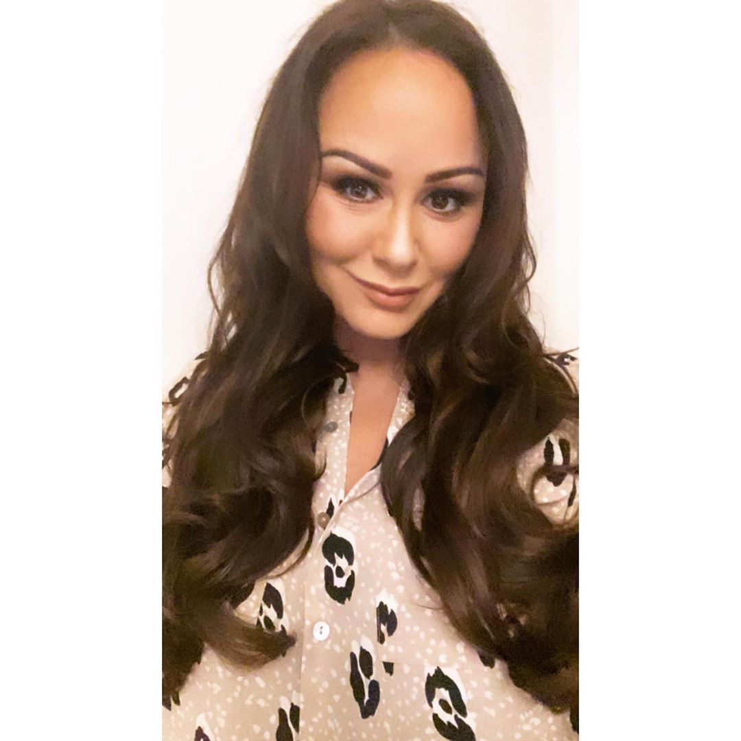 Big Brother's Chanelle Hayes share hair transplant result picture Big Brother's Chanelle Hayes share hair transplant result picture