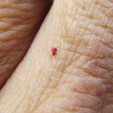 chigger red mite on skin