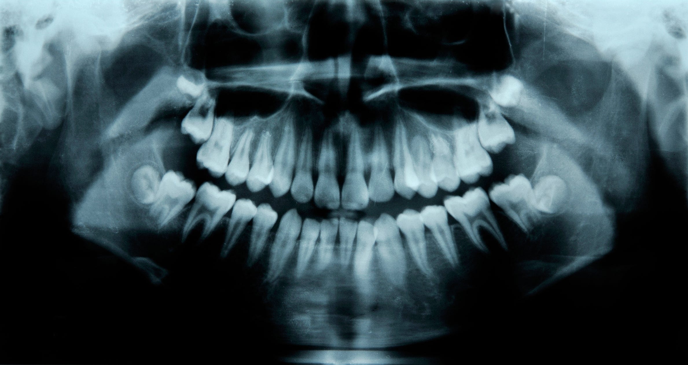 Humans Have a Third Set of Teeth. New Medicine May Help Them Grow.