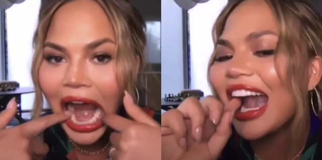 the ellen show chrissy teigen shows which teeth she lost from fruit roll up