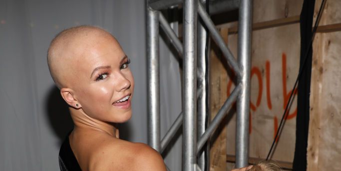Christie Valdiserri, la modelo que vive con alopecia