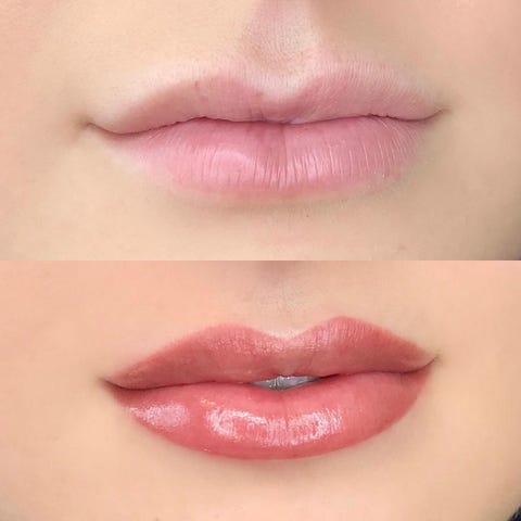 What Is Lip Blushing? - Permanent Lip Blush Tattoo Before/After