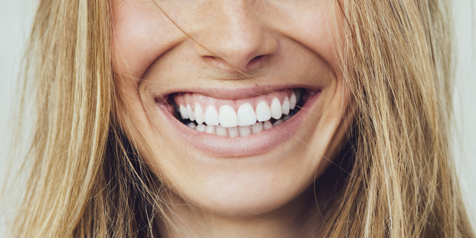 cheap dental aligners