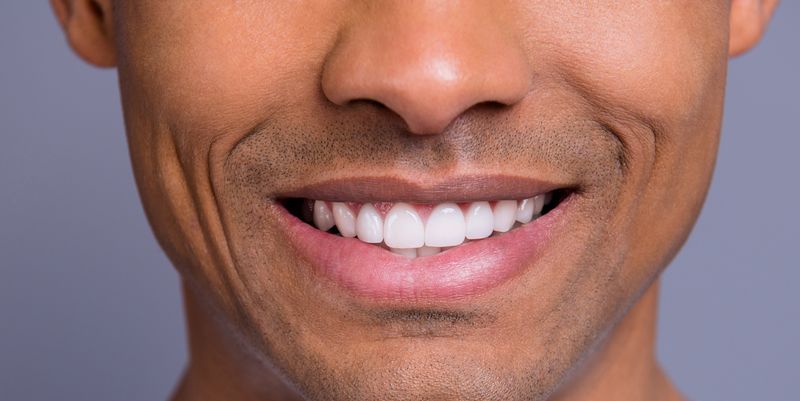 Whitening | Is It Safe, And Which At Home Kits Work?