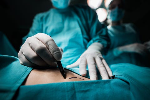 Close up of a doctor marking the human skin.