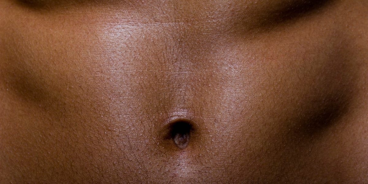 Dr Pimple Popper Removes A Sticky Belly Button Blackhead Dr Pimple Popper Removes A Sticky Belly Button Blackhead