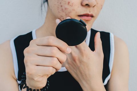 close up of asian woman worry about her face when she saw the problem of acne and scar by the mini mirror