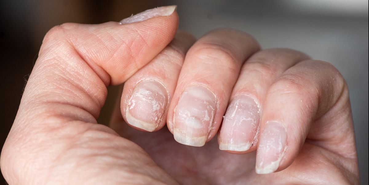Why peel my nails?