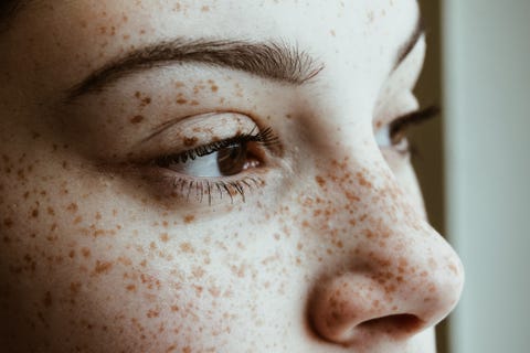 close up of thoughtful woman with freckles on face