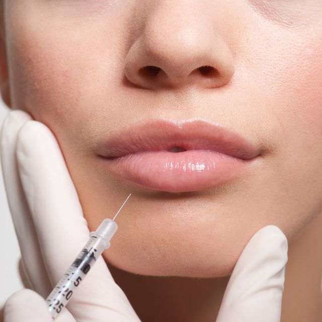 close up of woman receiving botox injection in lips