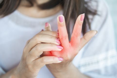 Close-Up Of Woman With Hands Itchy