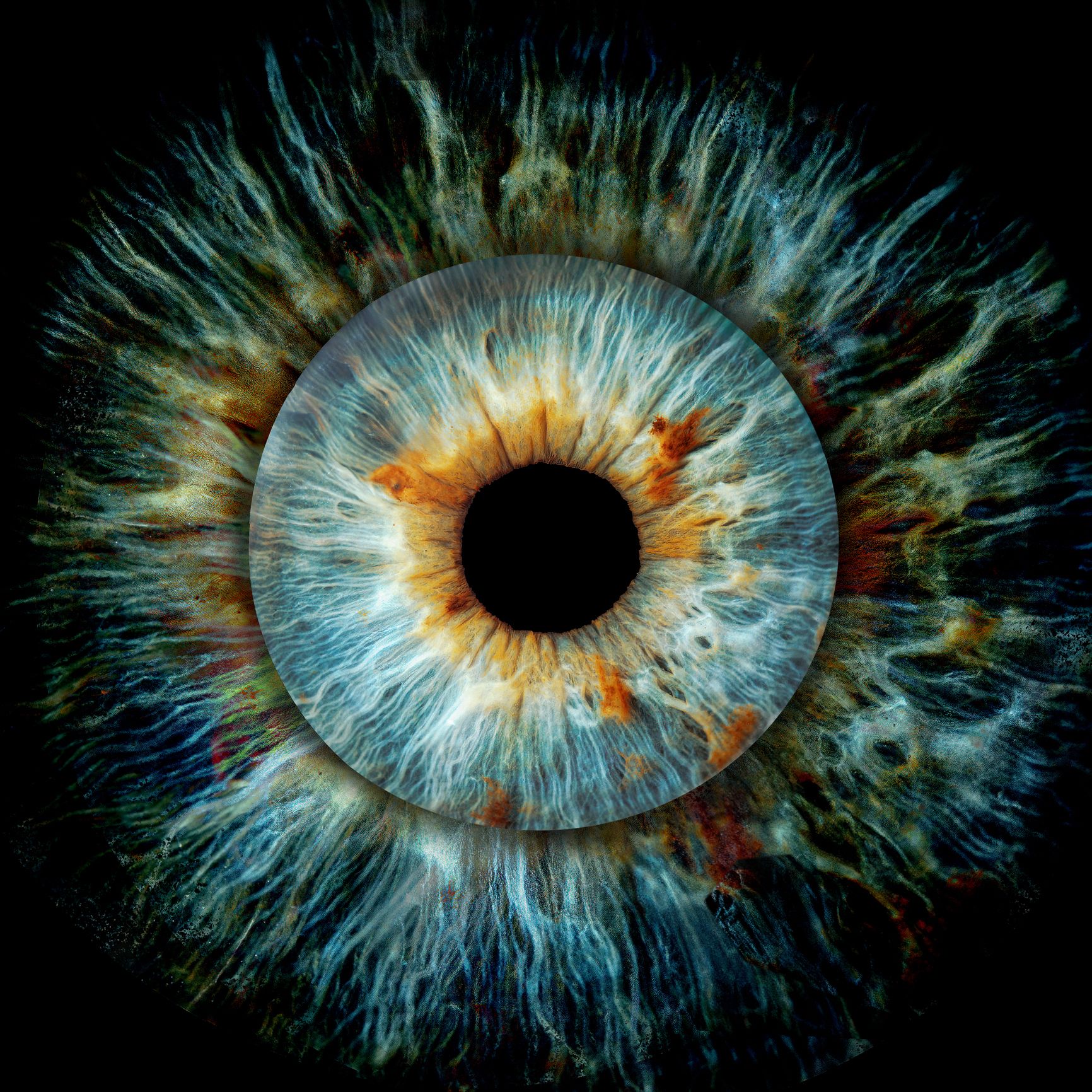 Scientists Found the Body's Switch for Regrowing Crucial Vision Cells. It Could Restore Sight for Millions of People.
