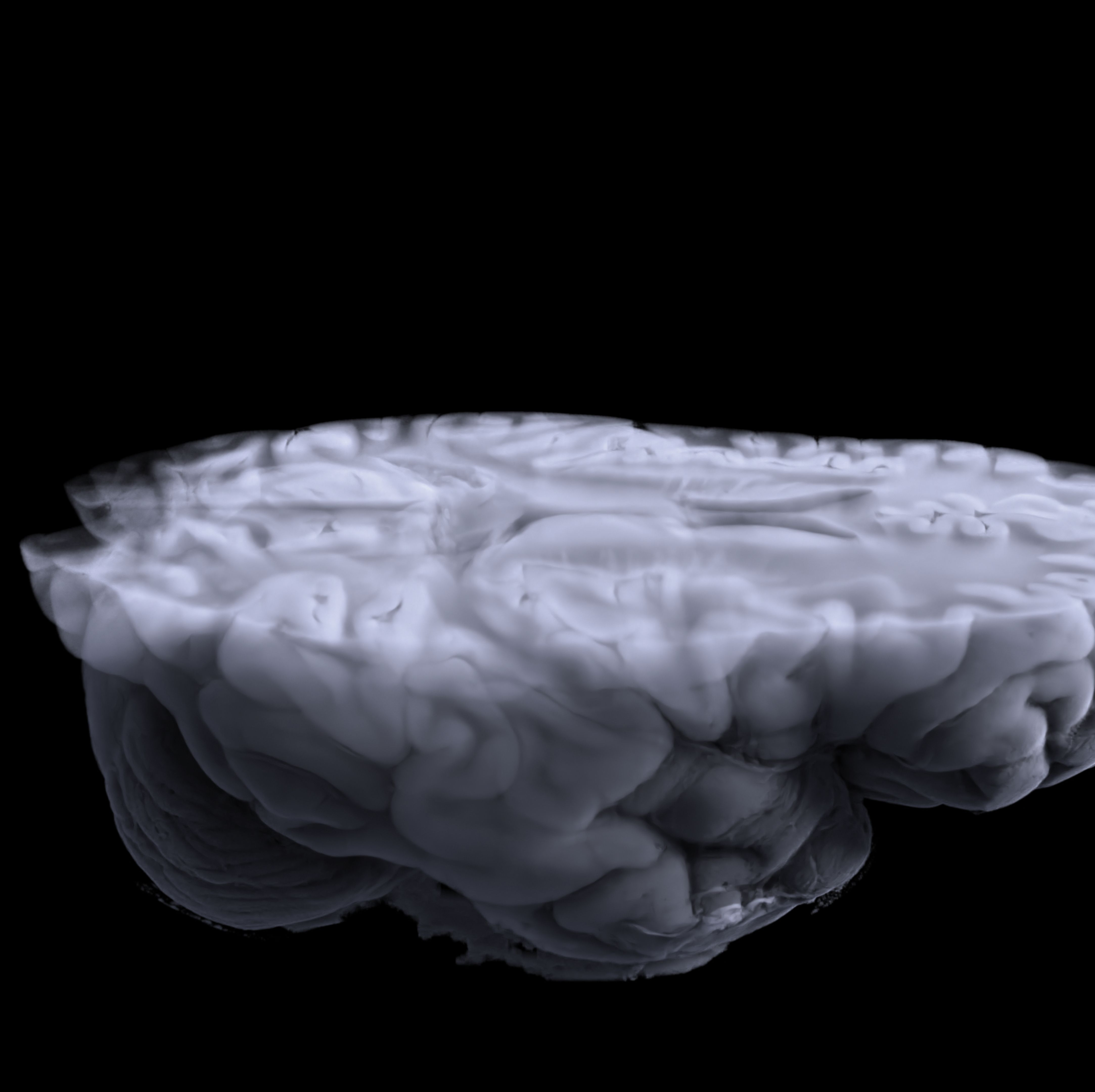 Human Brains Have Gotten Astonishingly Bigger Over the Last 75 Years