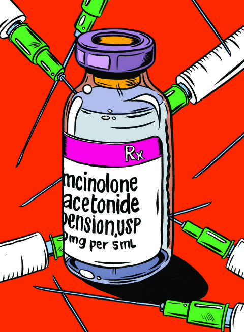 Cortisone injection