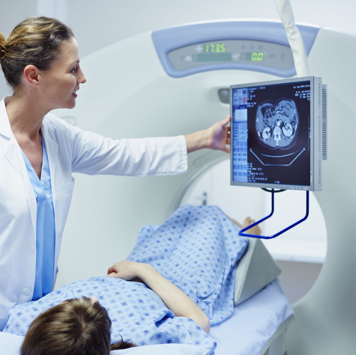 CT it works, side-effects, advantages
